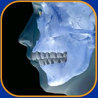 ceph xray