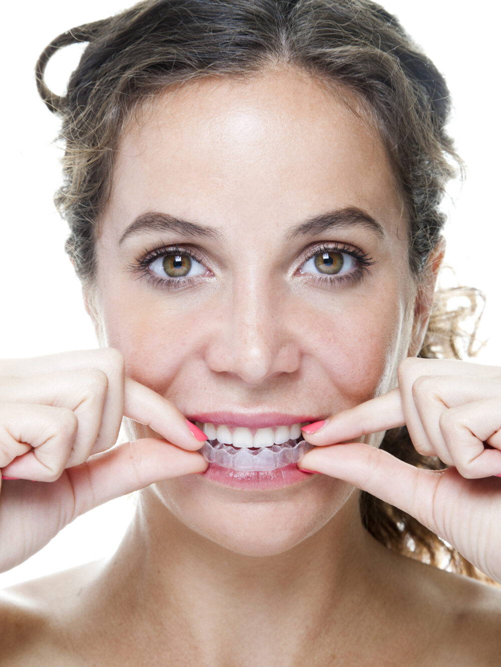 clear removable retainer Woman removing her clear retainer, demonstrating how she maintains her beautiful, healthy smile and lasting orthodontic results.